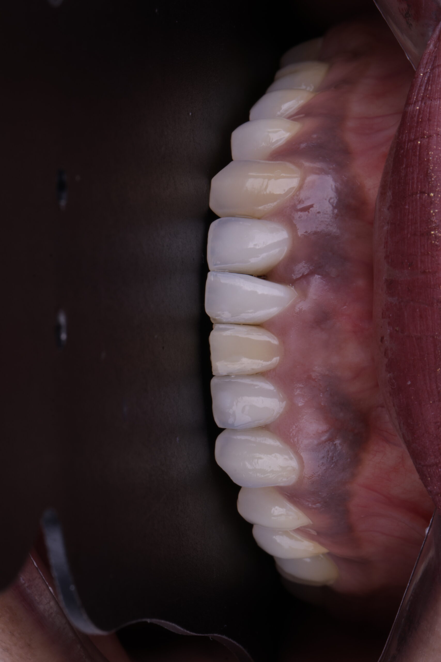 _27A8276 - Copia - Copia