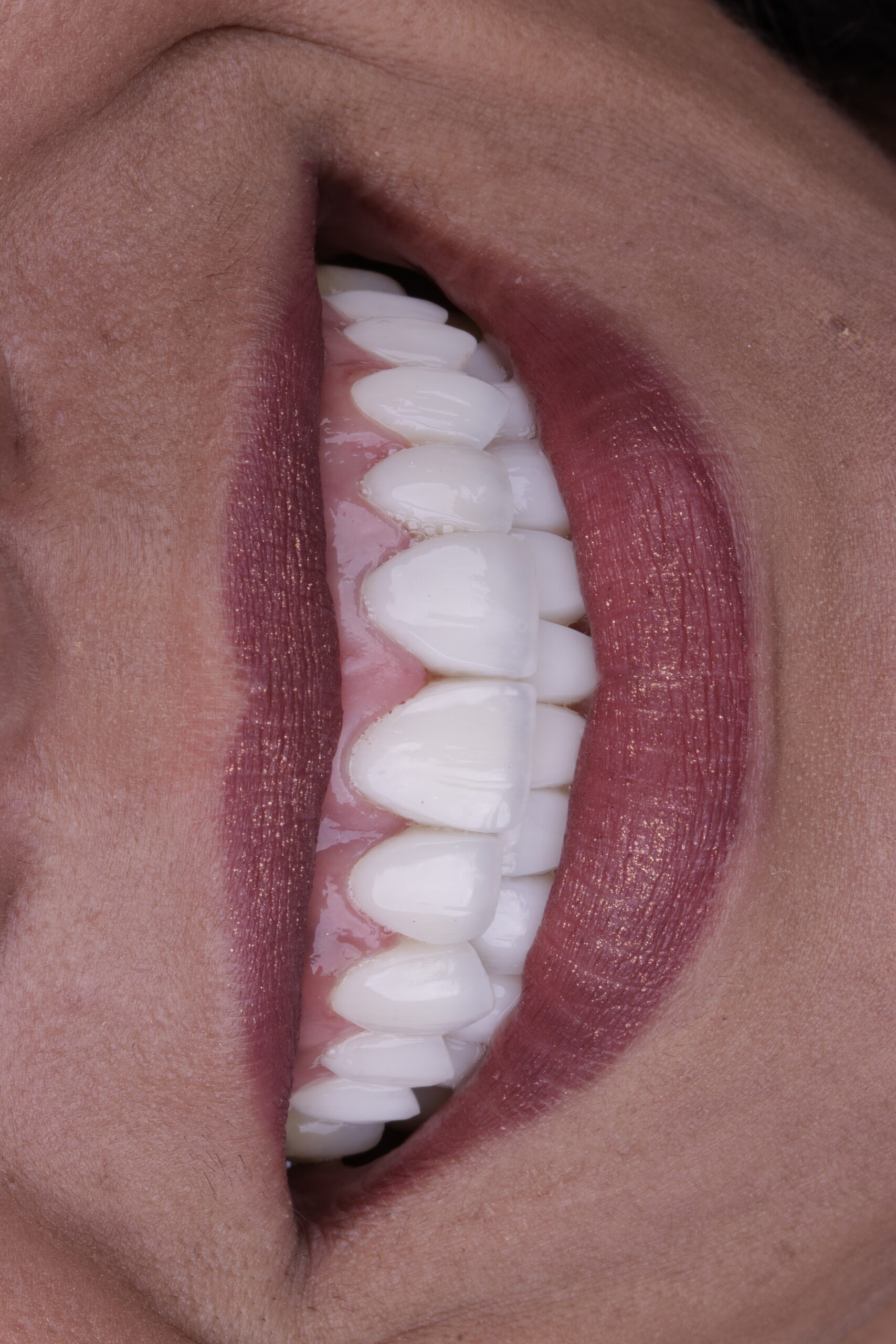 _27A8284 - Copia - Copia