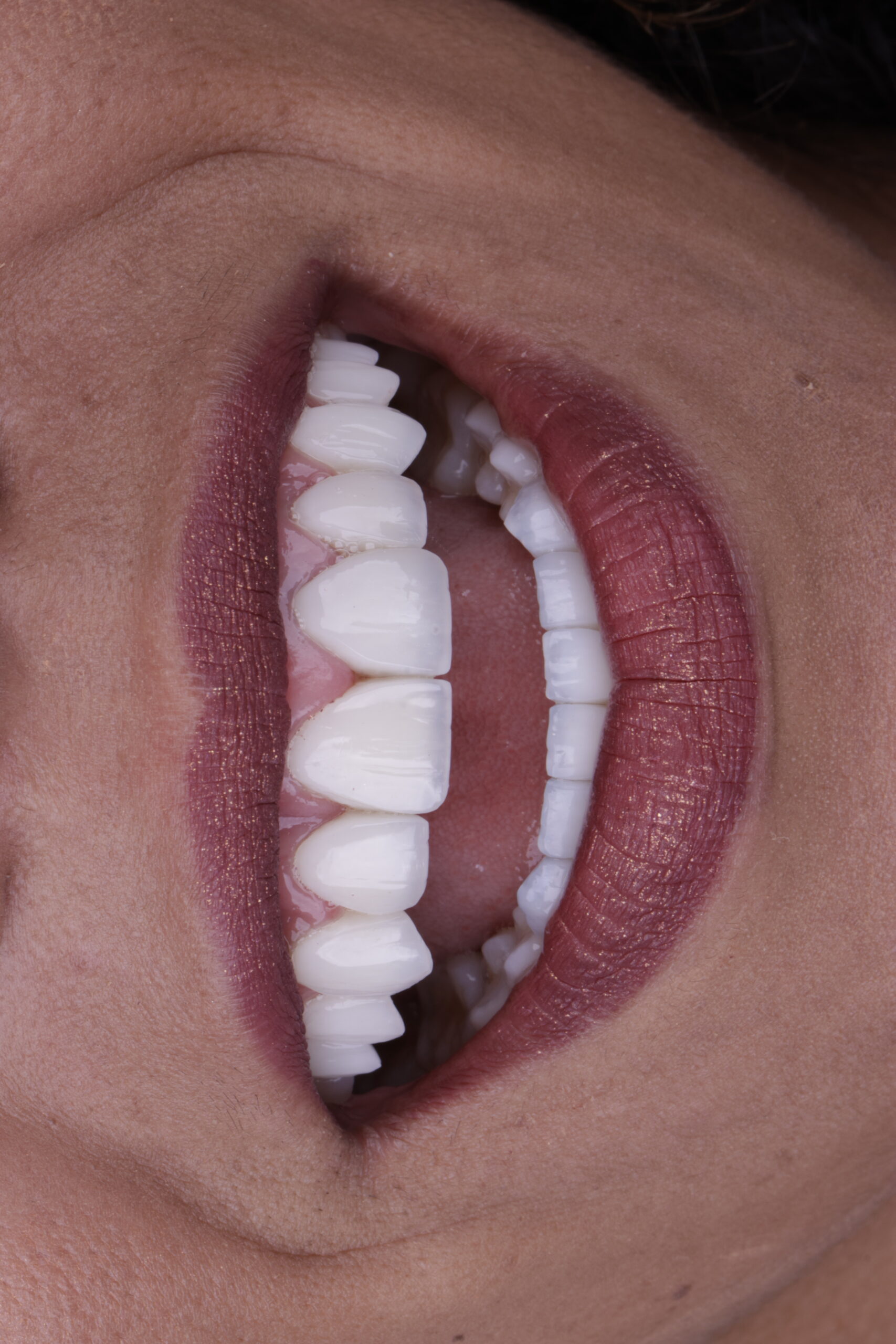 _27A8286 - Copia - Copia