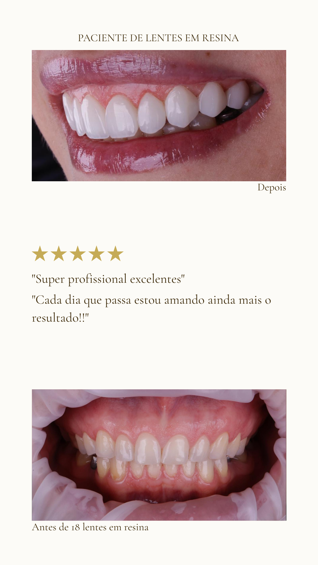 Profissional excelente!!! Nota mil!!! Passei por vários profissionais e foi a que mais fiquei satisfeita com o resultado, muito transparente, assertiva e honesta! Vale muito a pena seus serviços, (1)