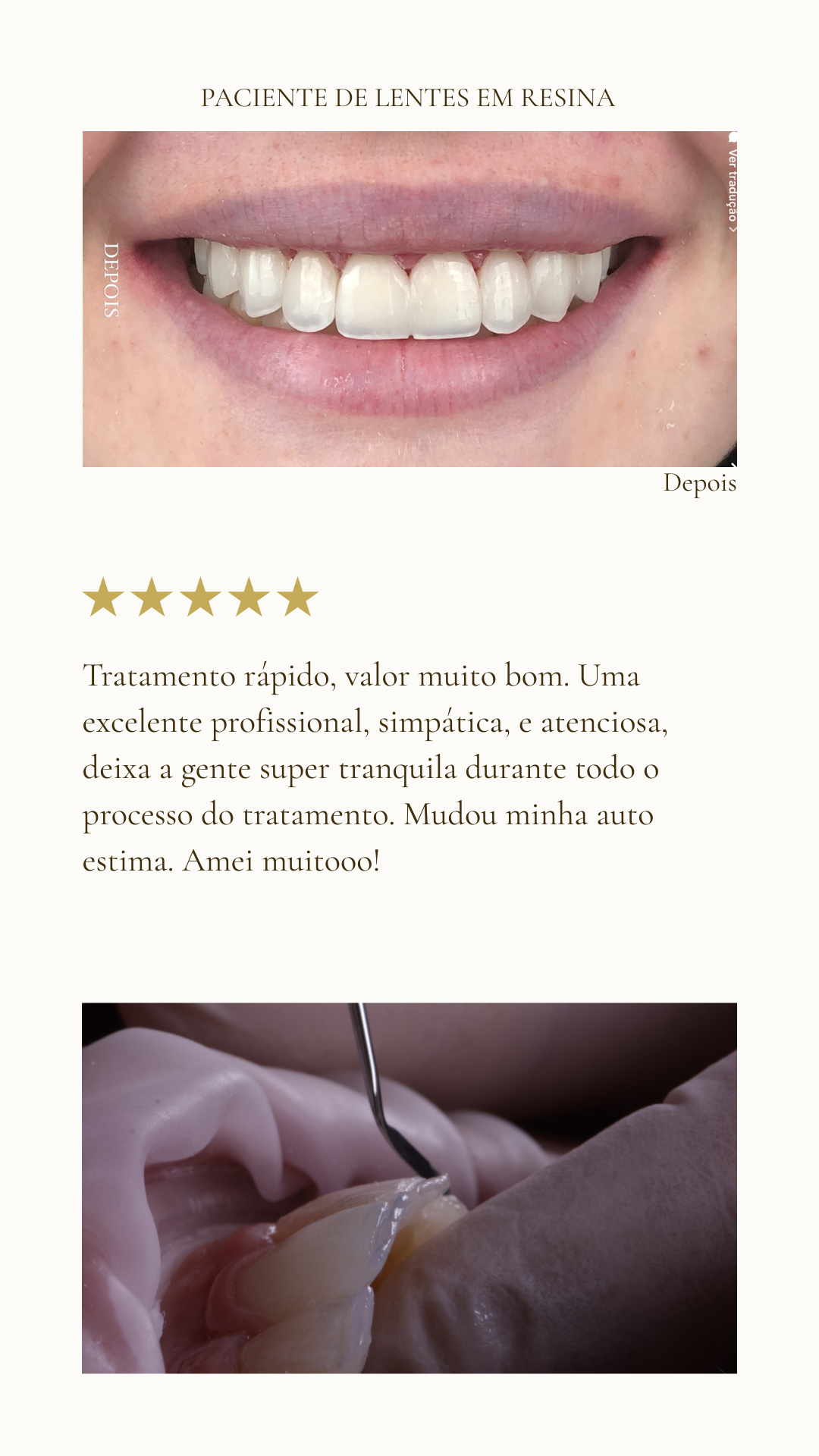 Profissional excelente!!! Nota mil!!! Passei por vários profissionais e foi a que mais fiquei satisfeita com o resultado, muito transparente, assertiva e honesta! Vale muito a pena seus serviços, (5)