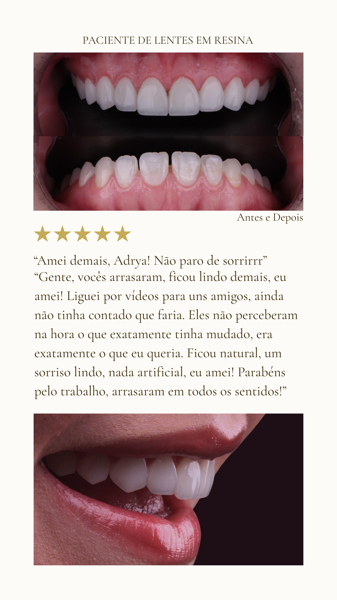 Profissional excelente!!! Nota mil!!! Passei por vários profissionais e foi a que mais fiquei satisfeita com o resultado, muito transparente, assertiva e honesta! Vale muito a pena seus serviços, (6)